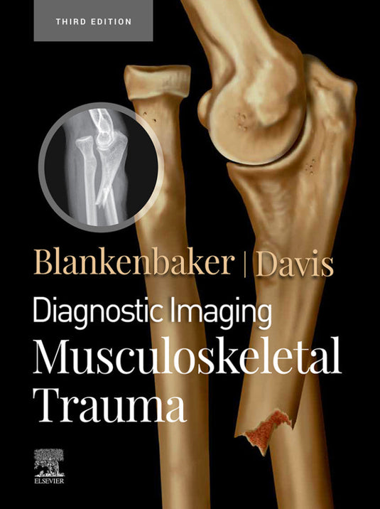 Diagnostic Imaging: Musculoskeletal Trauma 3rd Edition | PDF Download
