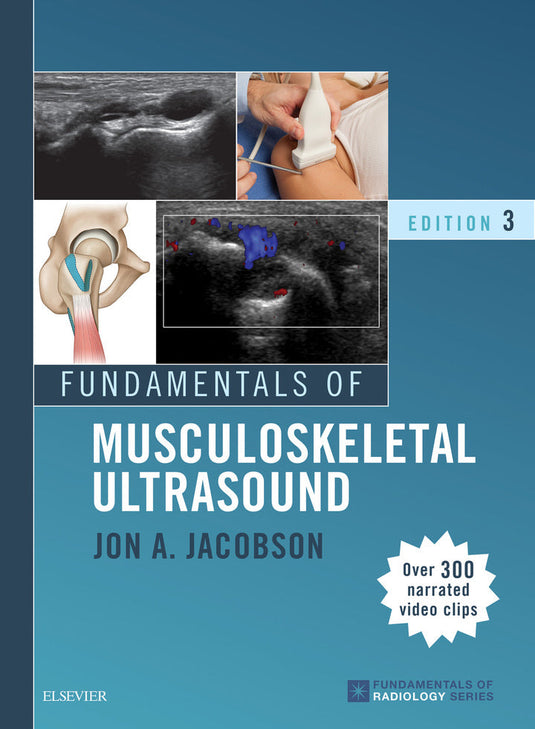 Fundamentals of Musculoskeletal Ultrasound 3rd Edition | PDF Download