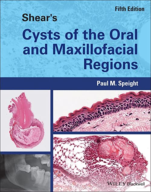 Shear's Cysts of the Oral and Maxillofacial Regions eBook cover