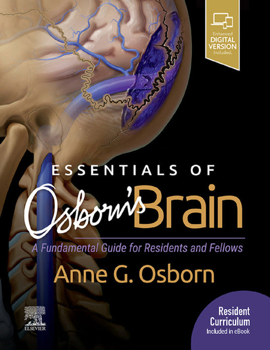 Essentials of Osborn's Brain: A Fundamental Guide for Residents and Fellows | PDF Download