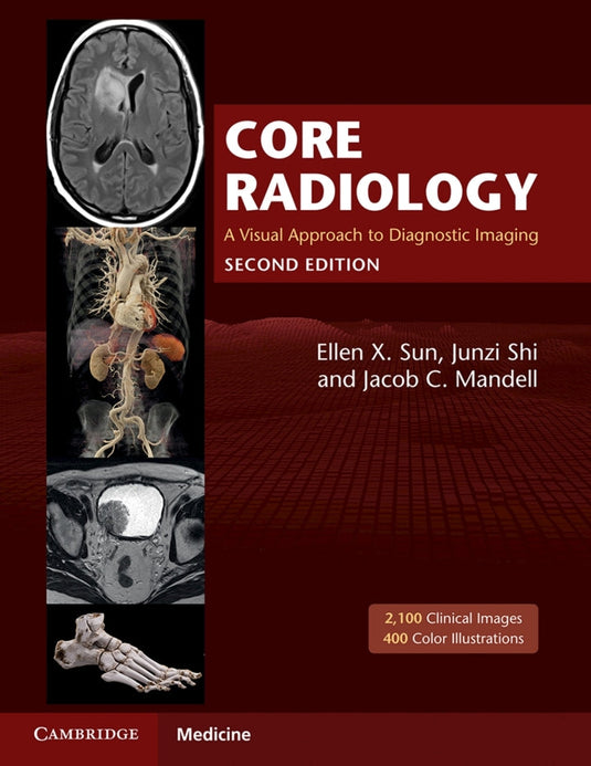 Core Radiology: A Visual Approach to Diagnostic Imaging 2nd