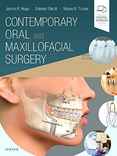 Contemporary Oral and Maxillofacial Surgery eBook cover
