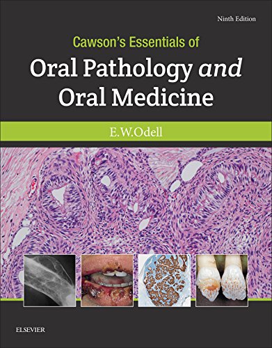 Cawson's Essentials of Oral Pathology and Oral Medicine E-Book 9th Edition