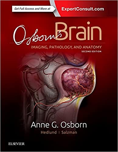 Osborn's Brain 2nd Edition