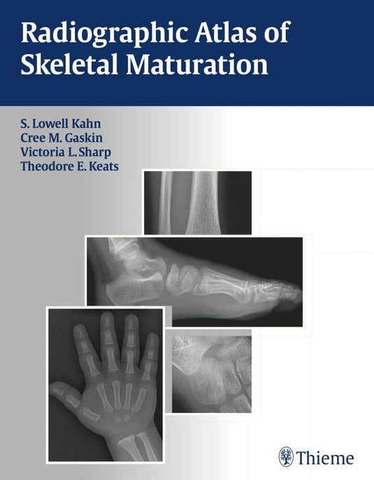 Radiographic Atlas of Skeletal Maturation 1st Edition  | PDF Download